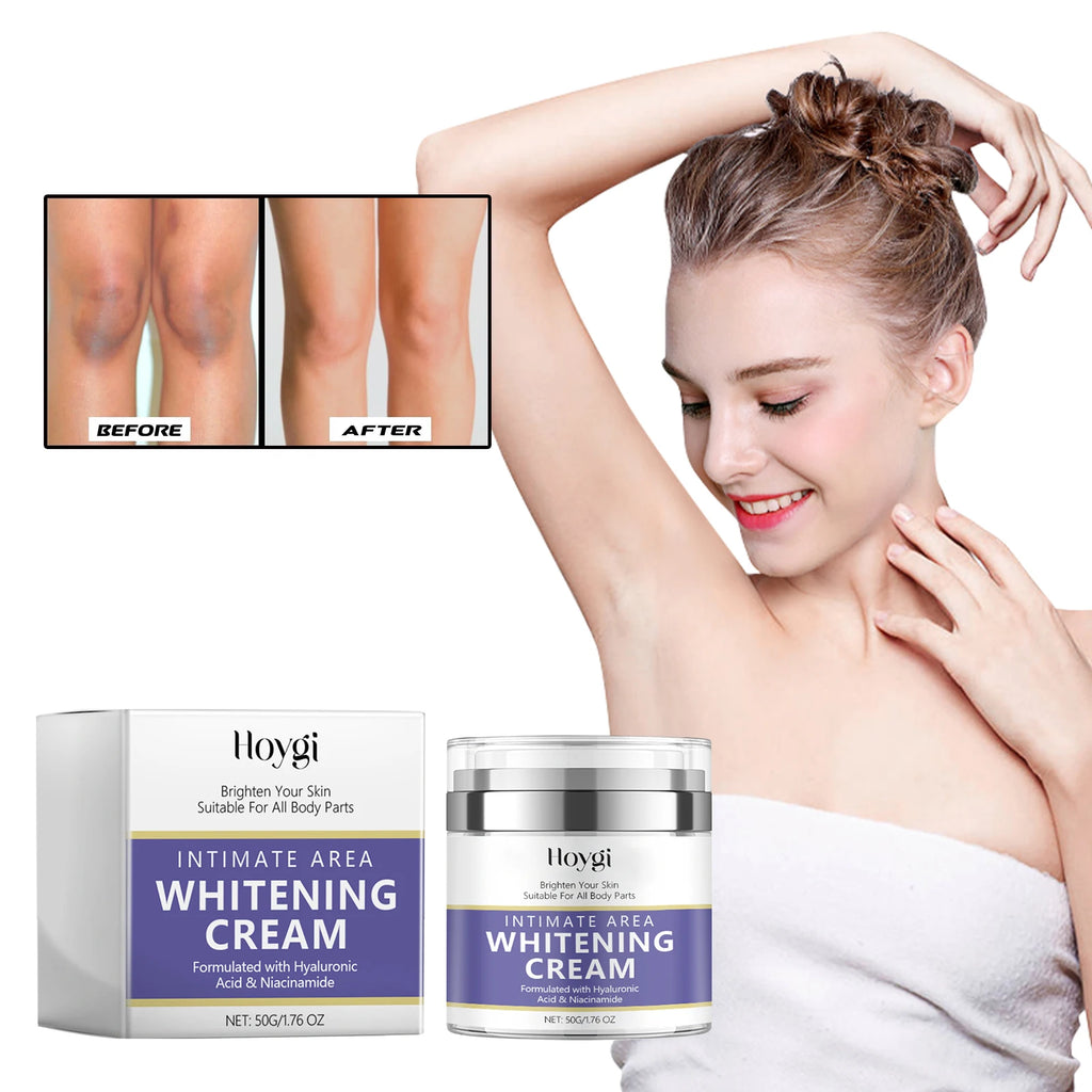 Hoygi Radiance Renewal Dark Spot Cream (50g)